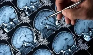 Những thói quen tưởng vô hại có thể gây đột quỵ khi trời lạnh